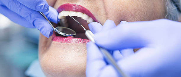 Best Dentist for Tooth Abscess  in Athens, TX